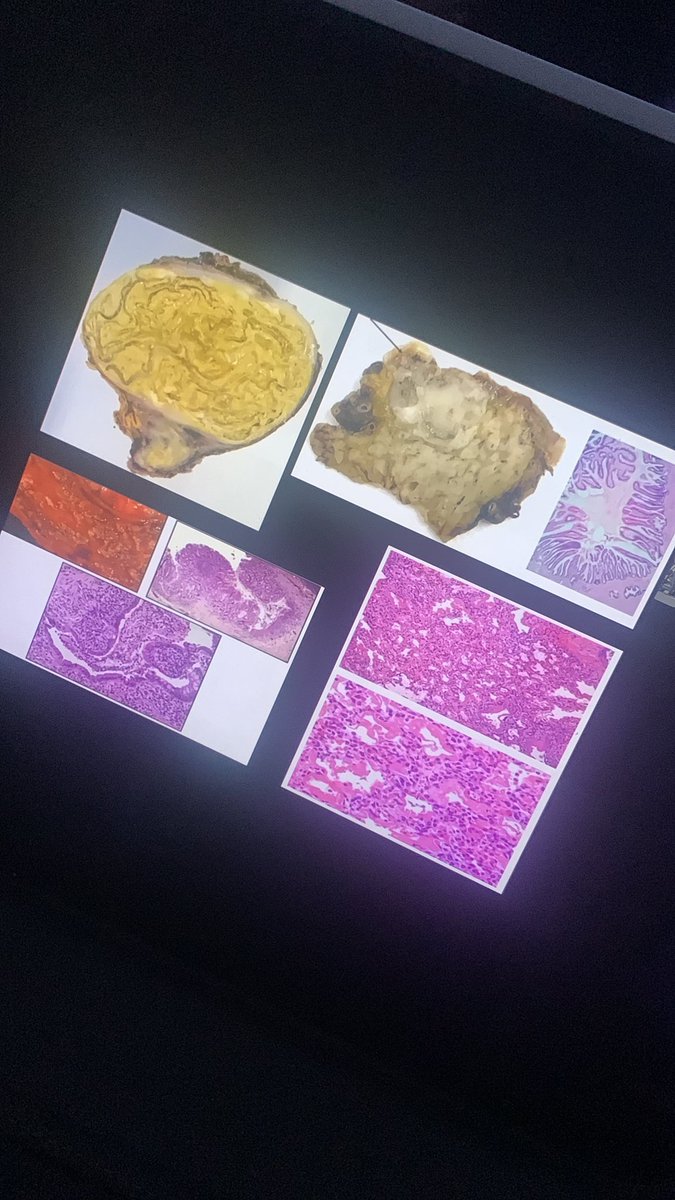 Martina5897's tweet photo. Estas fotos han aparecido en mi examen MIR. El trabajo de DIAGNOSTICAR enfermedades por muestras histológicas es de un MÉDICO ESPECIALISTA EN ANATOMÍA PATOLÓGICA. No de un recién graduado. @sanidadgob me pregunto qué buscáis haciendo estas preguntas… https://t.co/hJr7wCfTQi
