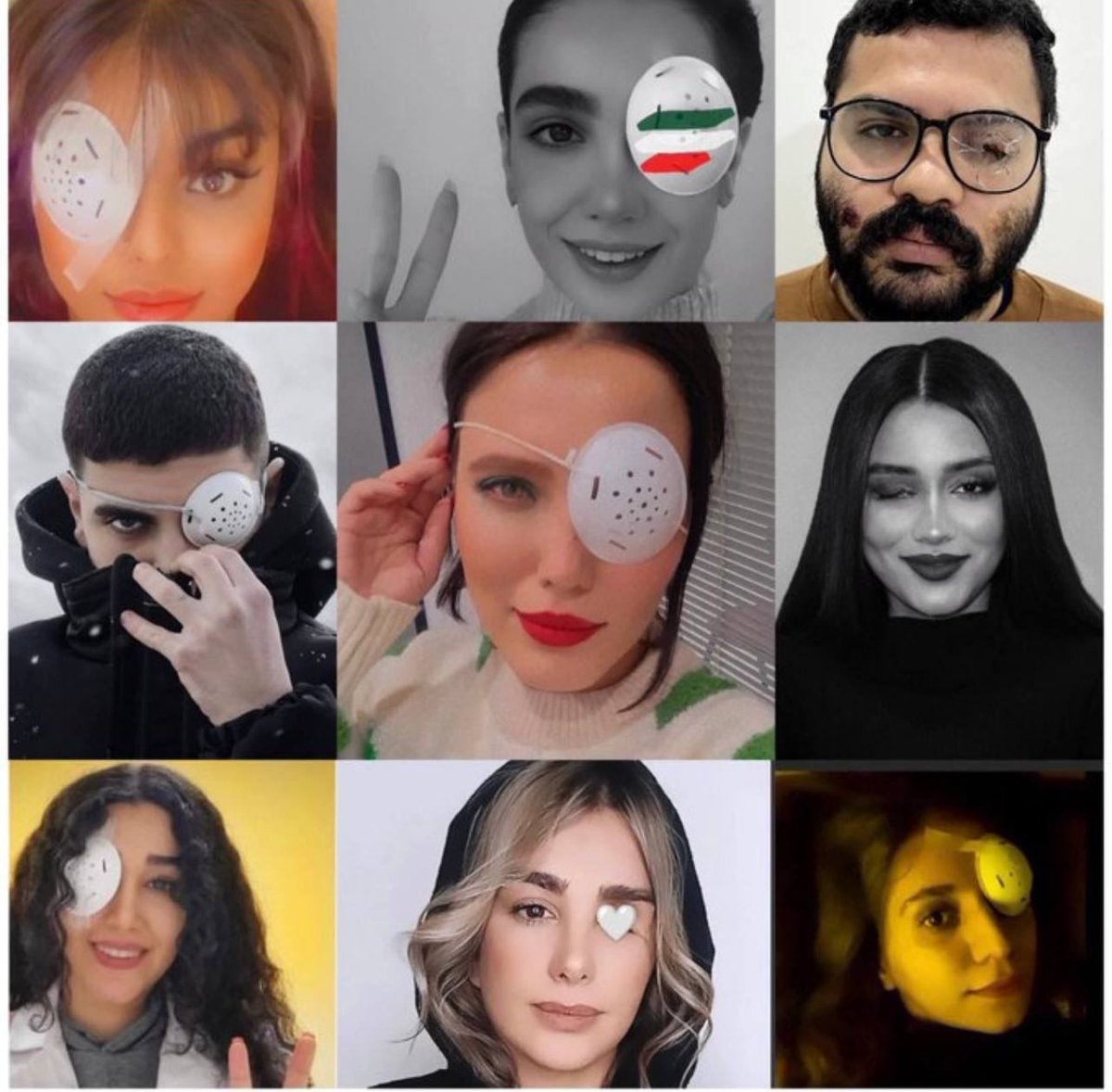 hdagres's tweet photo. Iranians who lost one eye at the hands of security forces during the ongoing protests in Iran are sharing photos of their faces online as a mark of pride and bravery. #MahsaAmini https://t.co/OkQtTWjIzo