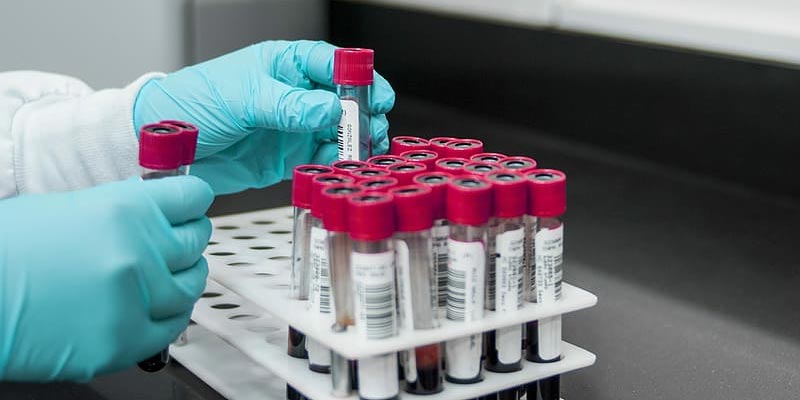 AlphaBioLabs's tweet image. PEth vs. EtG testing 

Which is more reliable? 
Our learning centre has the answers ⬇️
ow.ly/xGSf50MyN0S
#pethtesting #bloodalcoholtesting #alcoholtesting #legaltesting

30% OFF ALL LEGAL BLOOD ALCOHOL PEth TESTING UNTIL 28th FEBRUARY 2023. QUOTE PETH30.