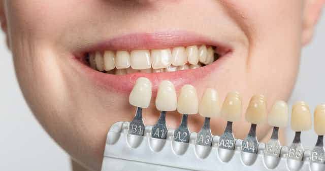 DatosDentista's tweet photo. La blancorexia es la obsesión por alcanzar el blanco perfecto en los dientes, esto es influenciado por la sociedad la publicidad, el cine y, en general, los medios de comunicación, siendo ignorado que los dientes naturalmente no son 100% blancos, esto depende de la dentina. https://t.co/AcL8IxDQuV