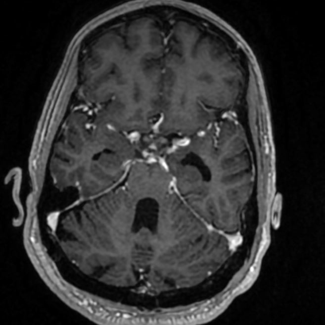 NeuroimagingN's tweet photo. https://t.co/2el5heHppE