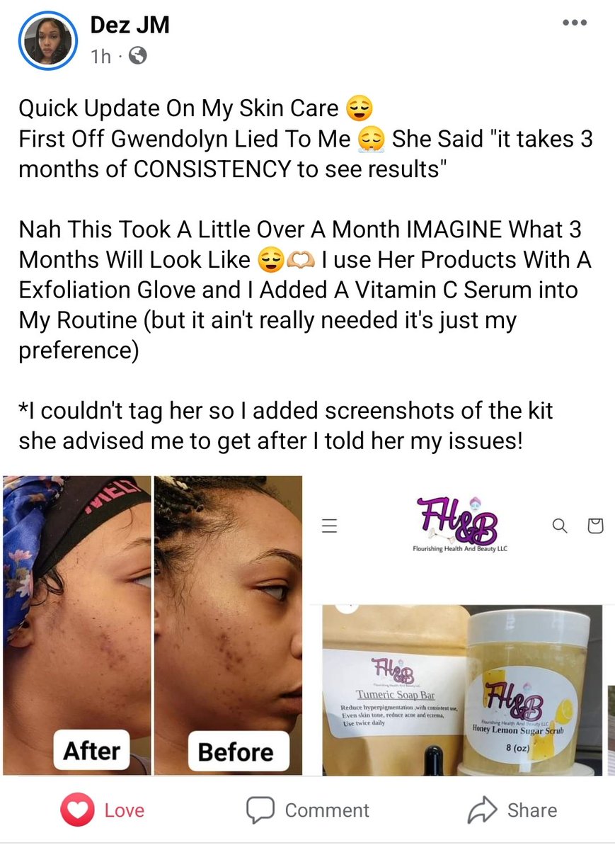 Gwendolyn0817's tweet photo. Thank you we love the reviews!https://t.co/PCTm9A2JwQ 
#skincareroutine #naturalskincareproducts #glowingskin #evenskin https://t.co/vCLl8Xln4Q