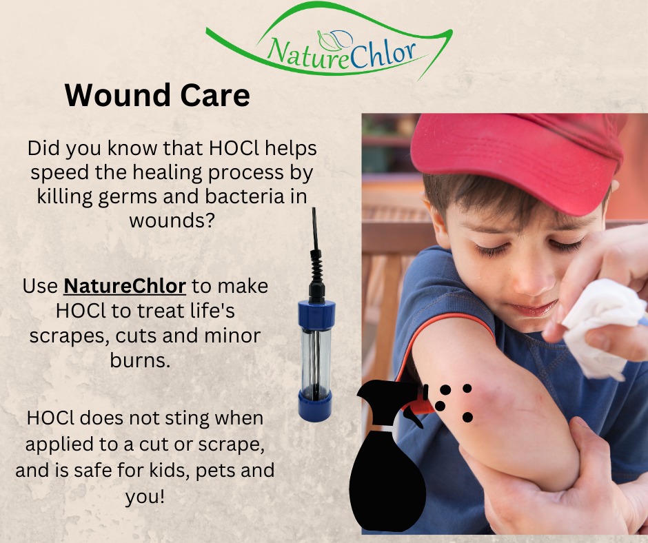 Treat minor wounds naturally with HOCl made with NatureChlor! It's safe, effective and non-irritating. Heal faster with HOCl. 
#naturechlor #woundcare #safe #firstaid #sanitize #KillGerms #diy #makeathome #skinsafe #kidsafe #petsafe #foodsafe #allnatural #organic #selfcare