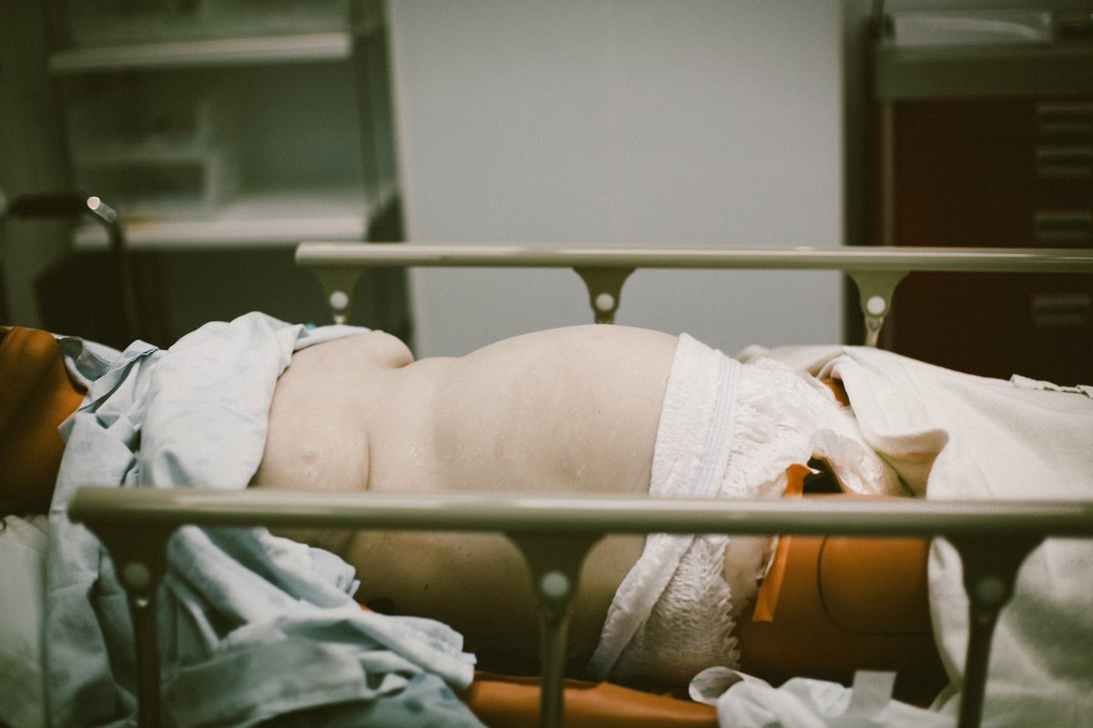 TheResusCourse's tweet image. Resuscitative hysterotomy day of course @hanawiemer teaching lots of pearls. Inspiration from @EmICUcanada excellent talks @DalEMCanada #emergencymedicine #FOAMed #FOAMcc