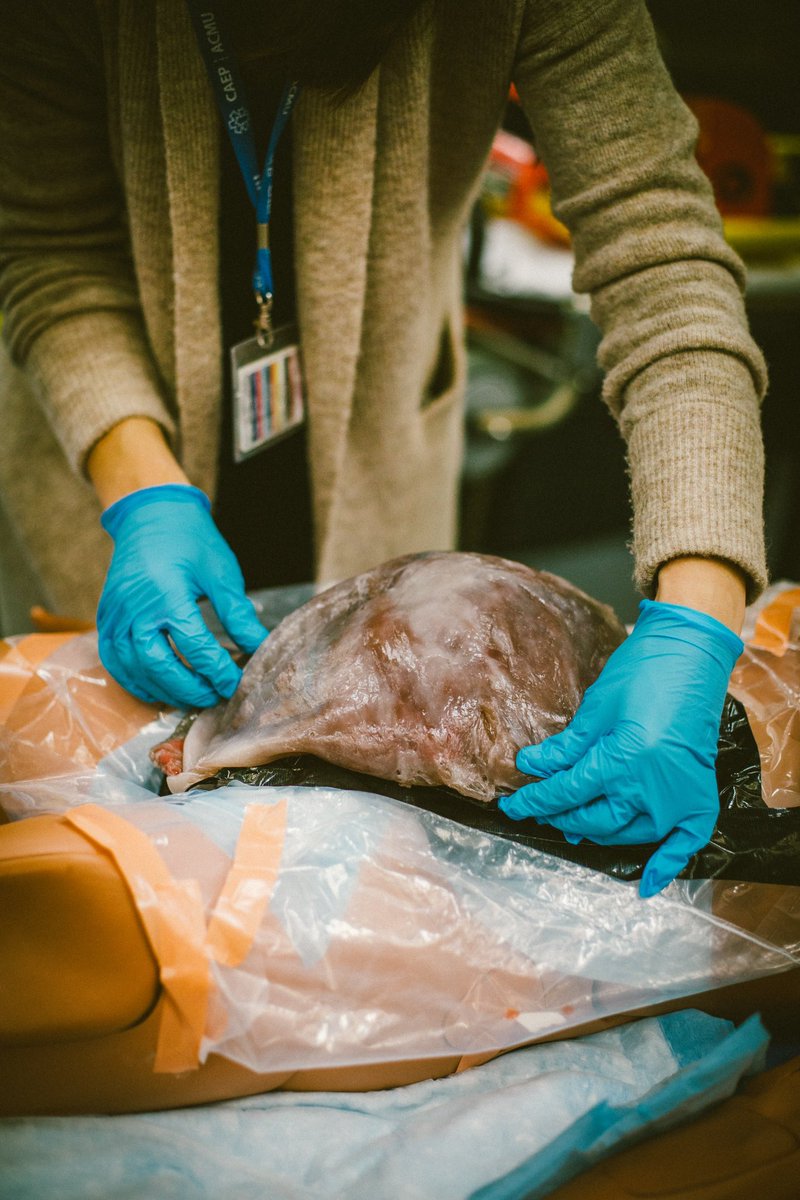 TheResusCourse's tweet image. Resuscitative hysterotomy day of course @hanawiemer teaching lots of pearls. Inspiration from @EmICUcanada excellent talks @DalEMCanada #emergencymedicine #FOAMed #FOAMcc