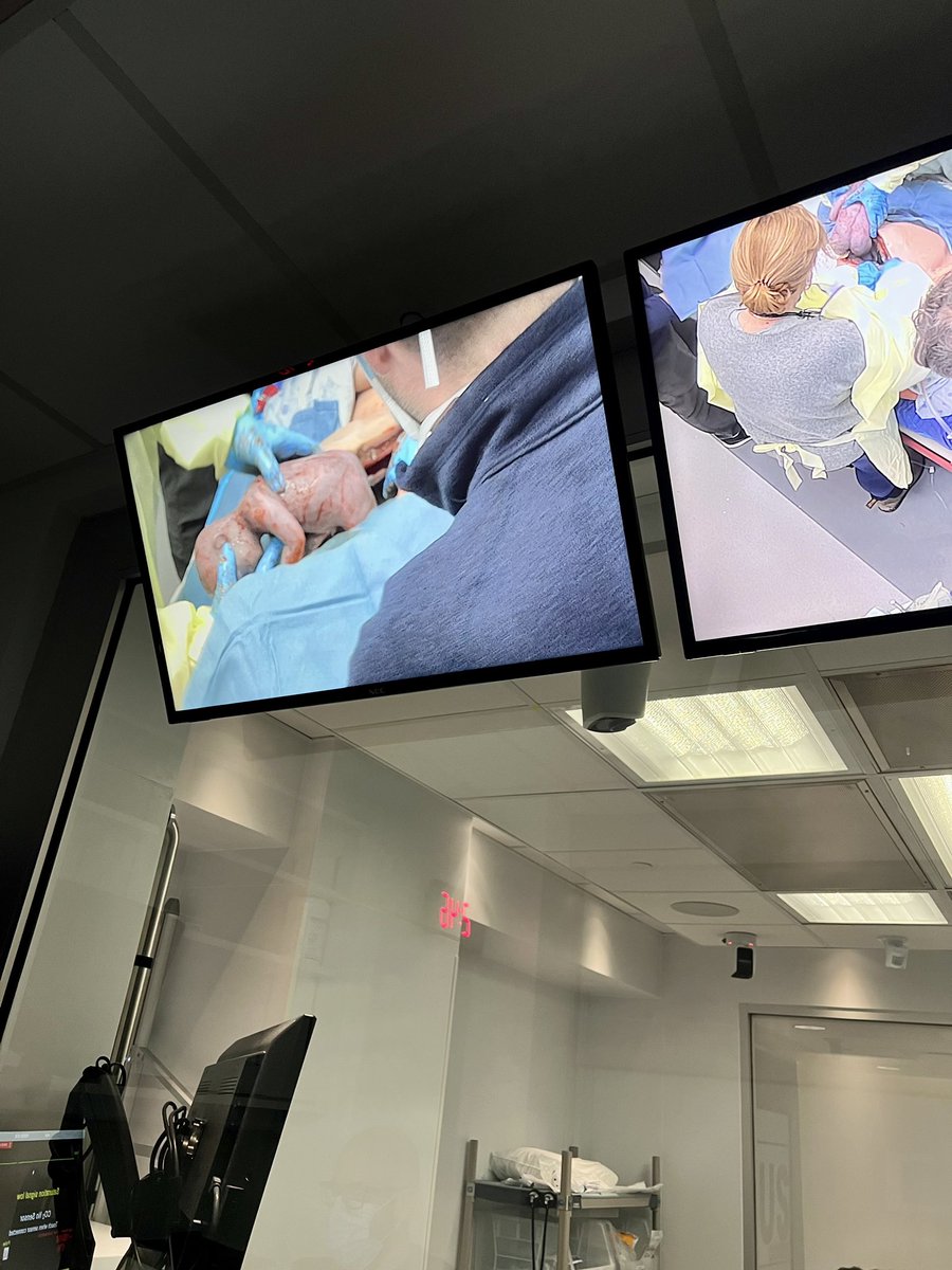 TheResusCourse's tweet image. Resuscitative hysterotomy day of course @hanawiemer teaching lots of pearls. Inspiration from @EmICUcanada excellent talks @DalEMCanada #emergencymedicine #FOAMed #FOAMcc