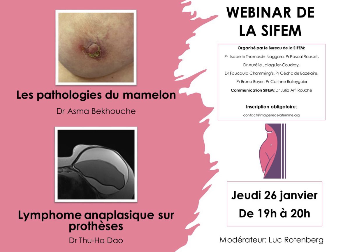 Webinar Sifem du 26 janvier 2023 à 19h00, inscrivez-vous:
contact@imageriedelafemme.org
<a href="/drrotenberg/">Dr Rotenberg</a>