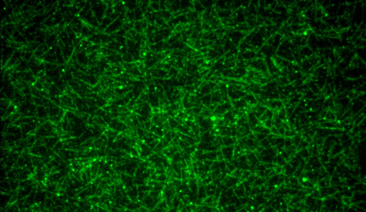 Sabine Petry (@labpetry) on Twitter photo Fantastic work by Michael Rale and colleages from <a href="/LabPetry/">Sabine Petry</a> featured with pic on the elife homepage: The conserved centrosomin motif, γTuNA, forms a dimer that directly activates microtubule nucleation by the γ-tubulin ring complex (γTuRC) doi.org/10.7554/eLife.… Fantastic work by Michael Rale and colleages from <a href="/LabPetry/">Sabine Petry</a> featured with pic on the elife homepage: The conserved centrosomin motif, γTuNA, forms a dimer that directly activates microtubule nucleation by the γ-tubulin ring complex (γTuRC) doi.org/10.7554/eLife.…