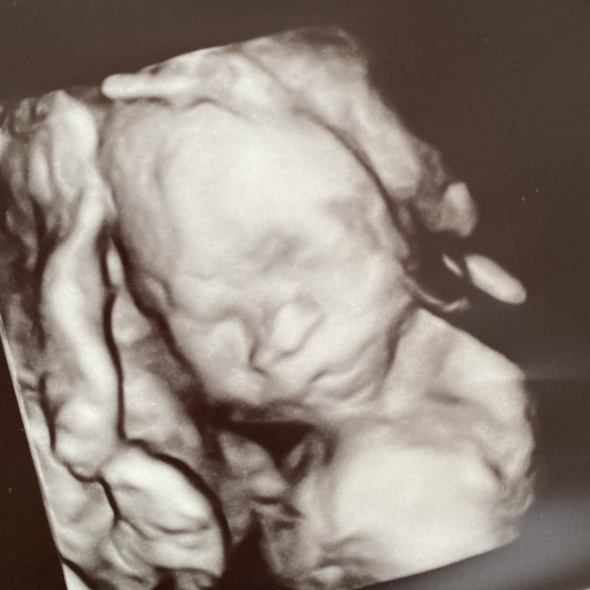 akaChaden's tweet photo. Thank you everyone for the birthday wishes today!  🎉⚔️🎉

I’m more excited for this little one’s birth-day coming up though! 😜 

#DadLife https://t.co/7b4OyM5v80