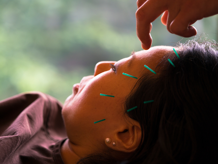 FaPaCcat's tweet photo. Acupuncture for Sleep: Get the Best Treatment for Your Best Zzz’s *** The types and benefits of acupuncture for sleep, plus tips for finding a practitioner. https://t.co/5HcsHv8ktY https://t.co/PAu3Dv7rak