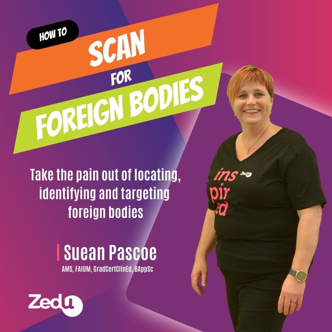zedunow's tweet image. The 1st #CoachingCorner for 2023 is almost here

Join Suean @i_c_sound as she talks the tips &amp;amp; tricks you can use to take the pain out of foreign bodies - for you &amp;amp; your patient

Join live &amp;amp; free on ZOOM
Thur 2 Feb 7.30pm AEST
🆓Register
ultrasoundtraining.com.au/resources/coac…
#POCUS #ultrasound