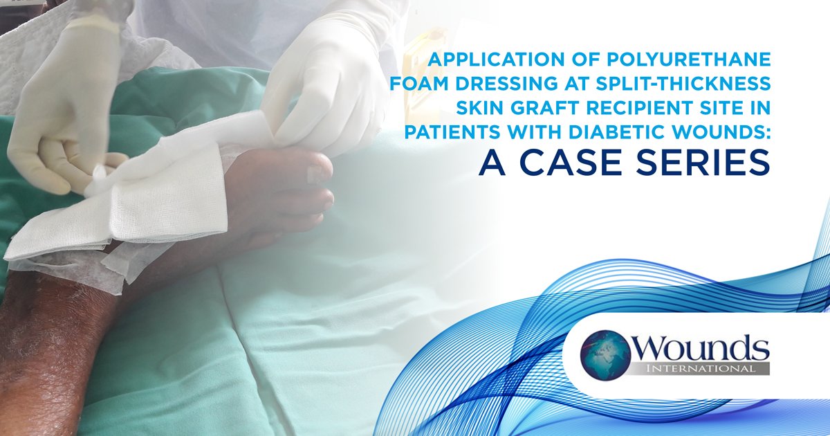 Wounds International on Twitter "This article aims to investigate use