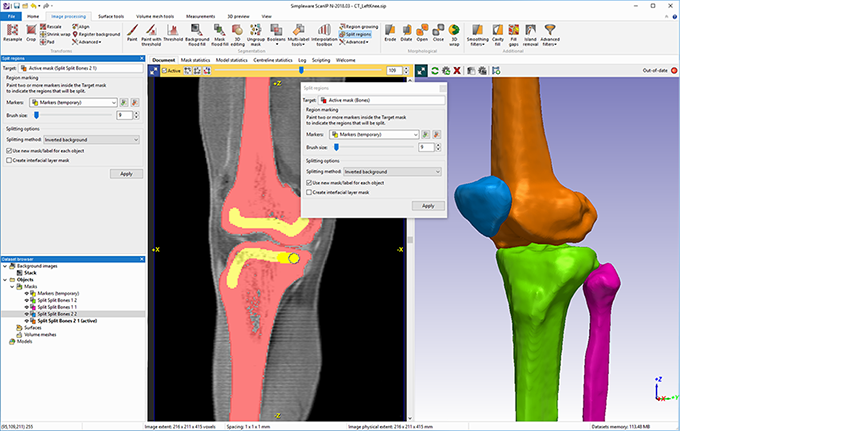 Simpleware_SNPS's tweet image. The @Simpleware_SNPS team have worked with @nTopology to develop a seamless patient-specific design workflow for customized surgical guides, leveraging AI-enabled image processing and design automation to handle common challenges.
bit.ly/3kJj5JH #medical3dprinting #dfam