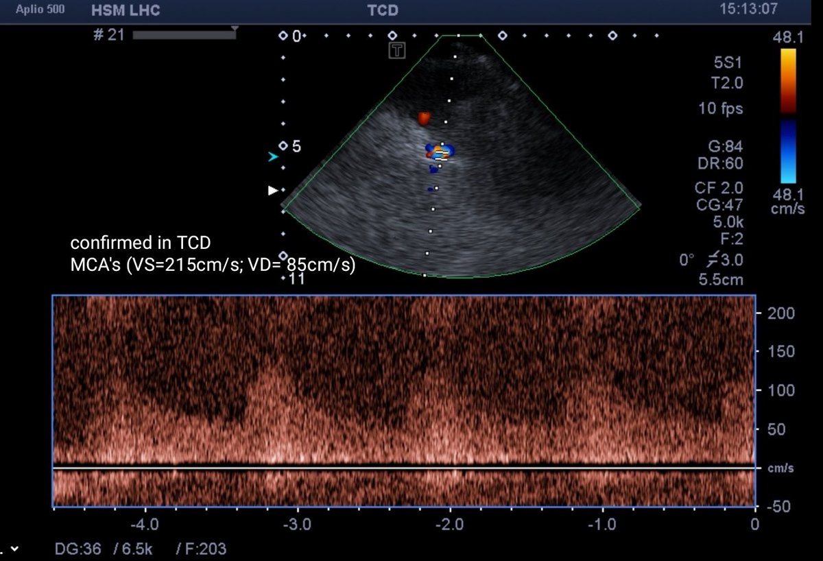 Neurosonology Lab - LHC tweet media
