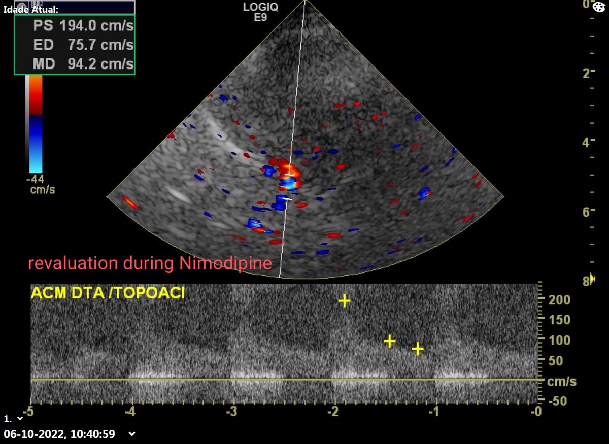 Neurosonology Lab - LHC tweet media
