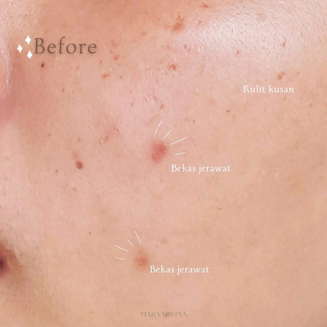 Stres Mengurus Google AdSense: Antara Harapan dan Kenyataan