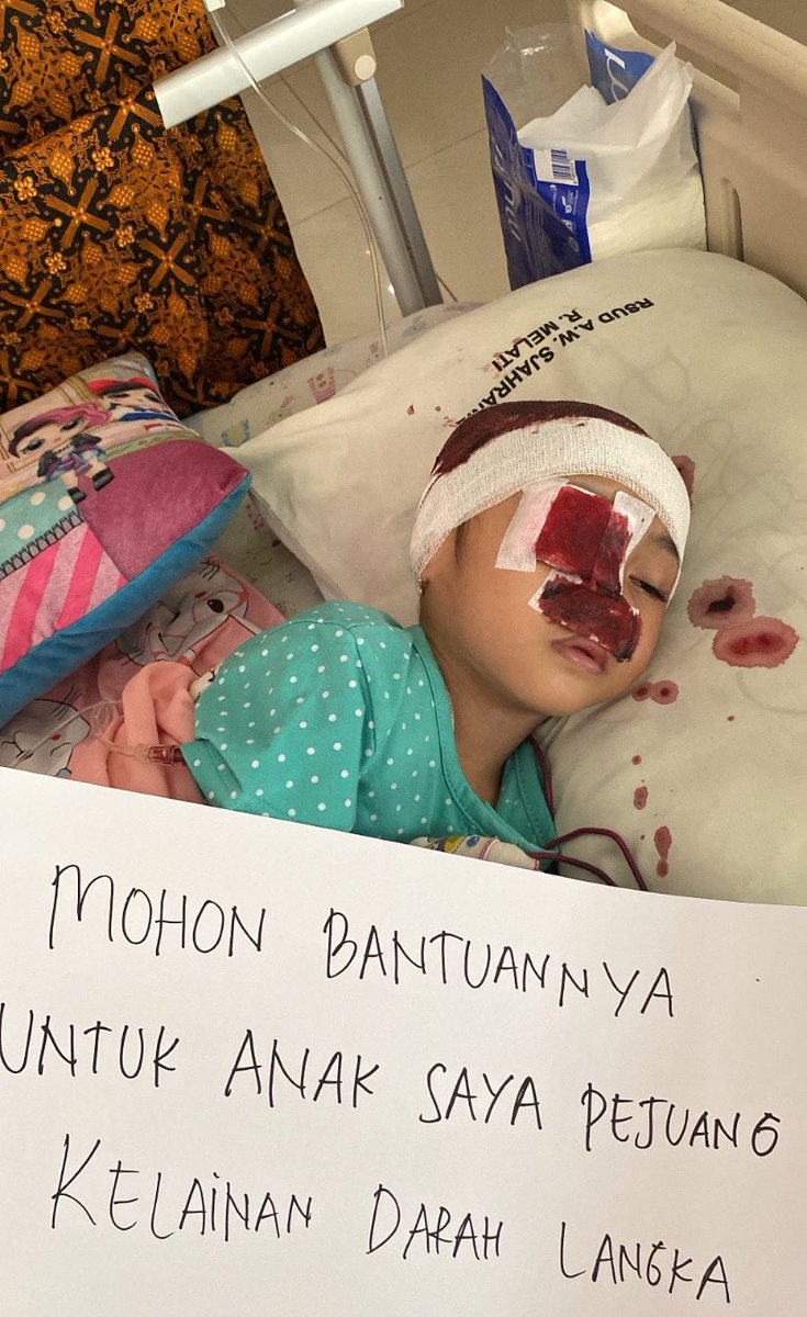 Lula sang pejuang BSS kembali dirawat di rs aws samarinda, dia kembali mengalami pendarahan dari hidung, telinga, pori pori kepala, mata dan dari kemaluan nya, kini dia kembali membutuhkan bantuan dari orang orang baik 🥹🙏