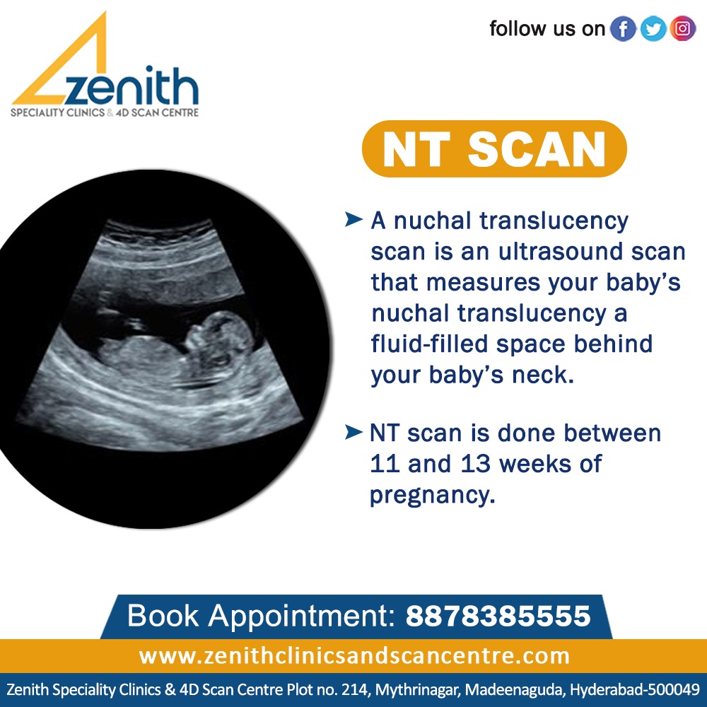 Zenith_Clinics's tweet image. An #NTscan is a common #screeningtest that occurs during the first trimester of #Pregnancy. This test measures the size of the clear tissue, called the #nuchaltranslucency, at the back of your #baby’sneck.

#Deepthikhambhampati #zenithspecialityclinics #femaleradiologist