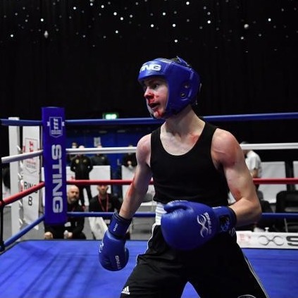AnthonyNolan's tweet image. 🚨 URGENT – REUBEN NEEDS YOUR HELP 🚨
Boxing star Reuben, 18, urgently needs to find his match. 
Recently diagnosed with Aplastic Anaemia after a boxing injury caused a nosebleed that wouldn’t stop, Reuben is searching for a donor. 
Join the register: bit.ly/3GU9VBy