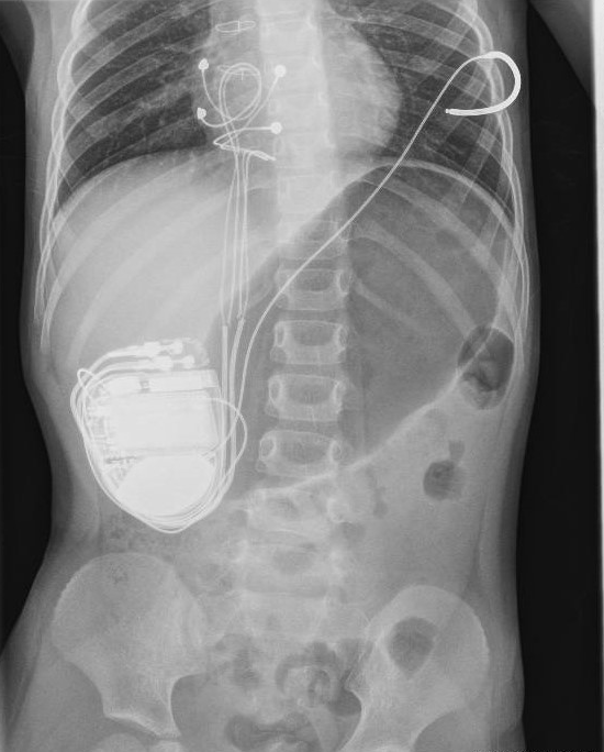 Eric Lim tweet media