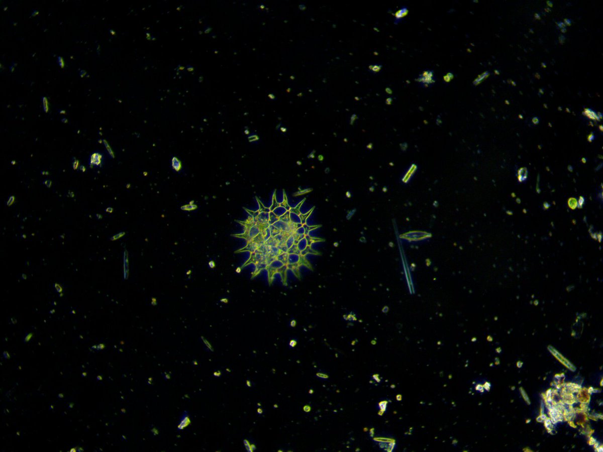 LakeMonsterGG's tweet photo. When you want a break from creating and want to explore, microscopy is a great way to do so.  Desmid and water bear found from the lake #microscopy #nature https://t.co/Gn88DkAgU1