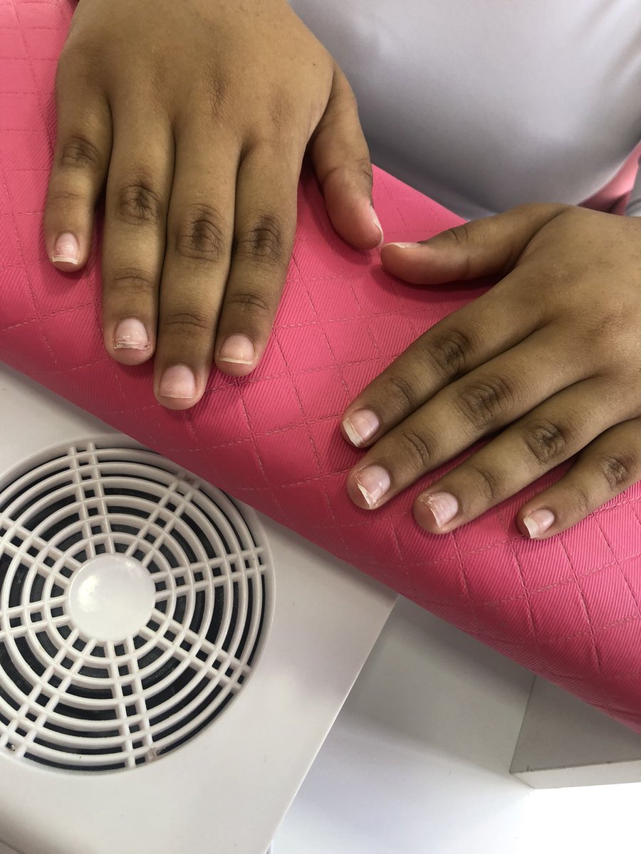 _annemoraess's tweet photo. Fibra de vidro 

Nail art - antes &amp; depois 

#alongamentodeunhas #unhasemgel #unhas #unhasdecoradas #esmaltacaoemgel #decoradas #decoraçao #vermelho #nailart #fibradevidro #gelnatips #gel #unhasbrasil https://t.co/Kzrb1tgum6