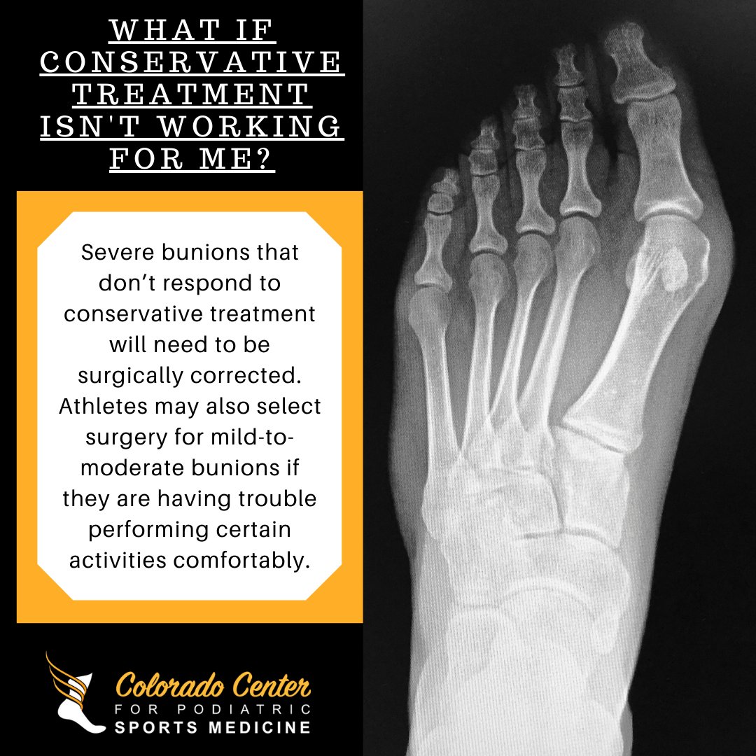 Let’s discuss your treatment options! Link in bio.
.
.
.
#bunion #bunions #footinjury #athlete #athletes #athletetraining #athleteperformance #sportsmedicine #sportspodiatry #coloradopodiatrist #longmontpodiatrist #ColoradoCenterForPodiatricSportsMedicine #CCPSM #DrJamesYakel