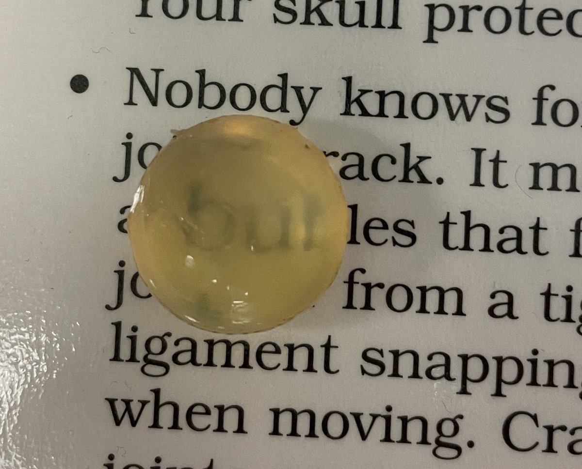mpsjscience's tweet photo. Our Gr 12 IB Bio students were excited to dissect cow eyes and discover the pretty retina and large convex lens within. 🐮 👁️ @MPSJ_TCDSB @PowerIB #mpsjbio https://t.co/y1dTANMXbh
