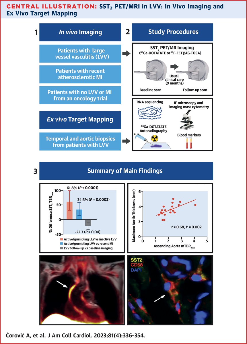 PET/MR imaging using somatostatin receptor radionuclide tracers holds major promise for diagnosis and therapeutic monitoring of large vessel vasculitis. bit.ly/3wuKcLq

#JACC #Atherosclerosis #MolecularImaging #thinkPET #cvPET #CardioTwitter
