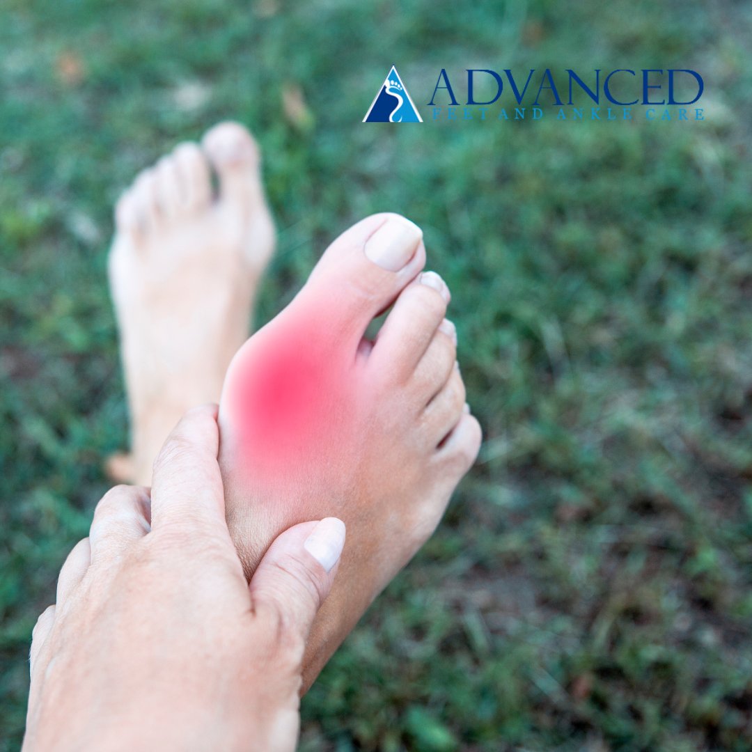AdvancedFeet tweet picture