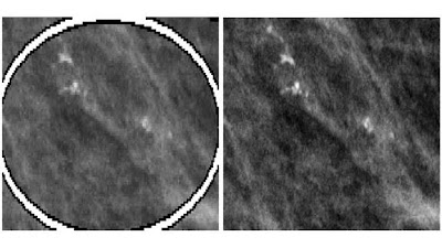 Radiology: Artificial Intelligence (@radiology_ai) on Twitter photo 20% of @EmoryRadiology Breast Imaging Dataset dataset will be freely available for research doi.org/10.1148/ryai.2⦠@haritrivedimd <a href="/judywawira/">Judy Gichoya</a> @imonbanerjee6 #BreastCancer #tomosynthesis #diversity 20% of @EmoryRadiology Breast Imaging Dataset dataset will be freely available for research doi.org/10.1148/ryai.2⦠@haritrivedimd <a href="/judywawira/">Judy Gichoya</a> @imonbanerjee6 #BreastCancer #tomosynthesis #diversity