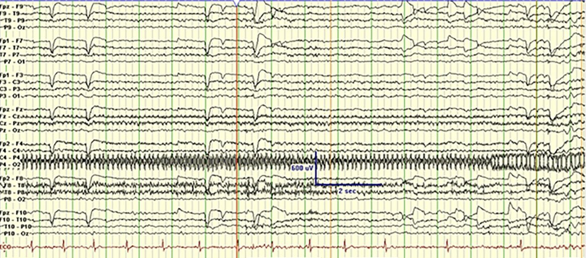 Lyell Jones MD tweet media