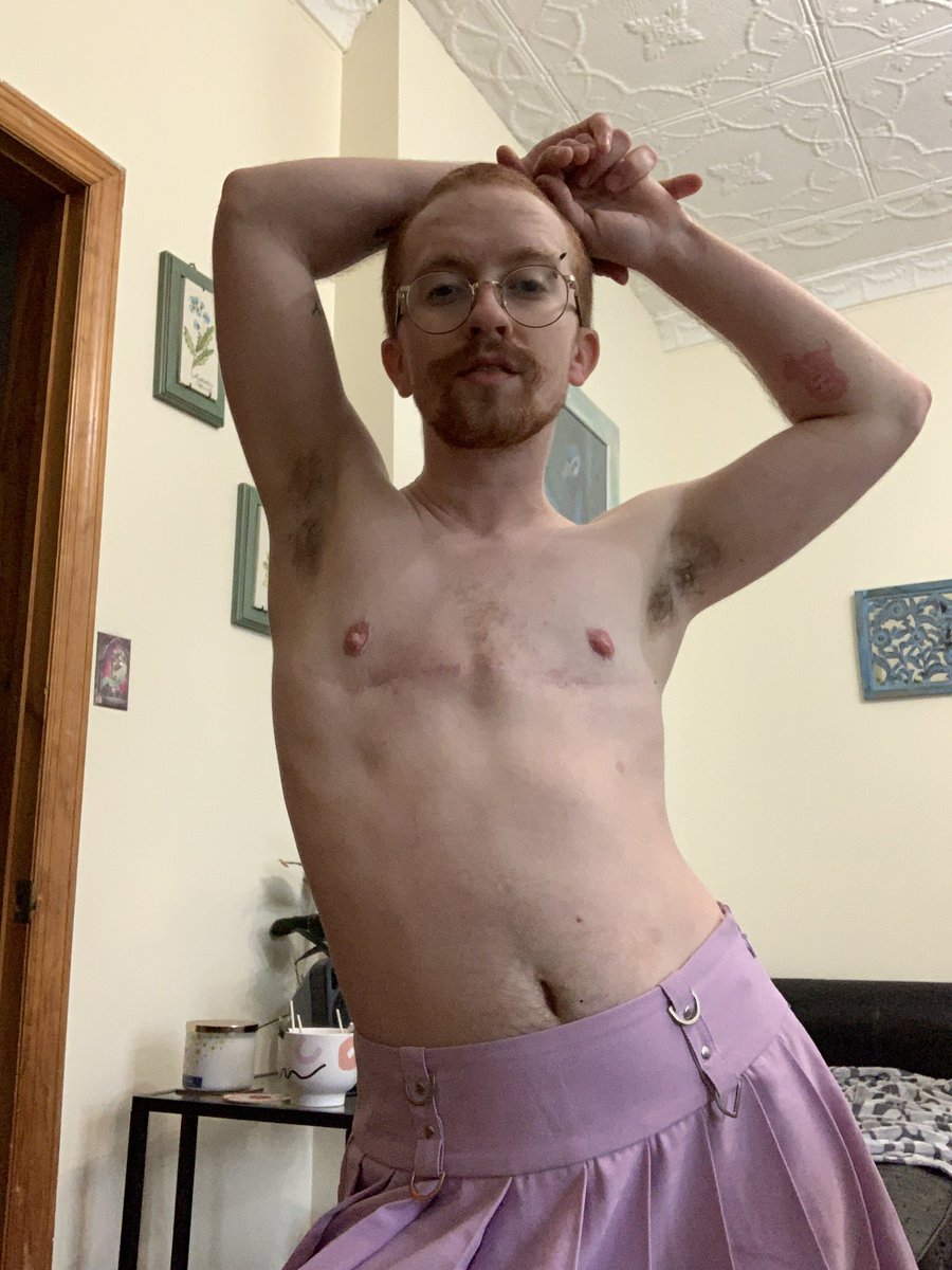 andycaspian's tweet photo. it’s been forever since i’ve done a top surgery recovery update so here we go 🙇🏼🙇🏼 https://t.co/riQJoL8KHv