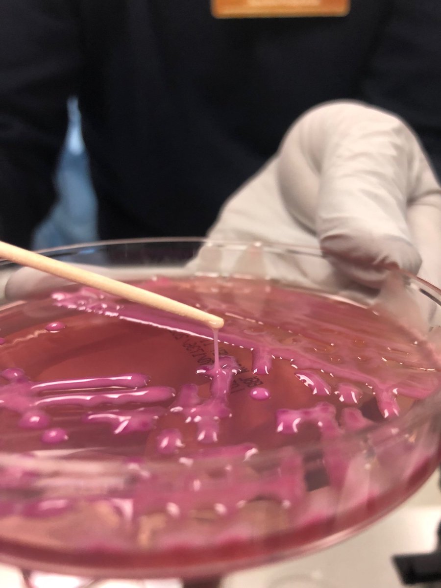 mICROBIOsh's tweet photo. Fenotipo hipermucoviscoso de Klebsiella pneumoniae hipervirulenta 💗 https://t.co/n37FWZCMFa