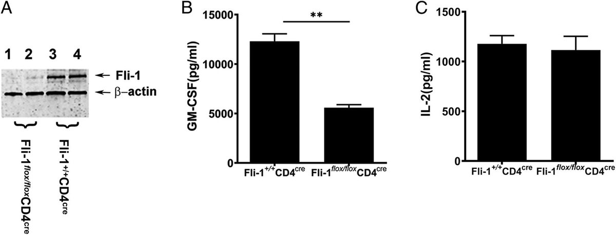 J_Immunol's tweet image. #ICYMI from Xian K. Zhang @MedUnivSC | Fli-1 is a novel #transcriptionfactor regulating expression of #GMCSF &amp;amp; could be a therapeutic drug target | #ReadTheJI #immunology 👉 ow.ly/IYfy50Mupvs