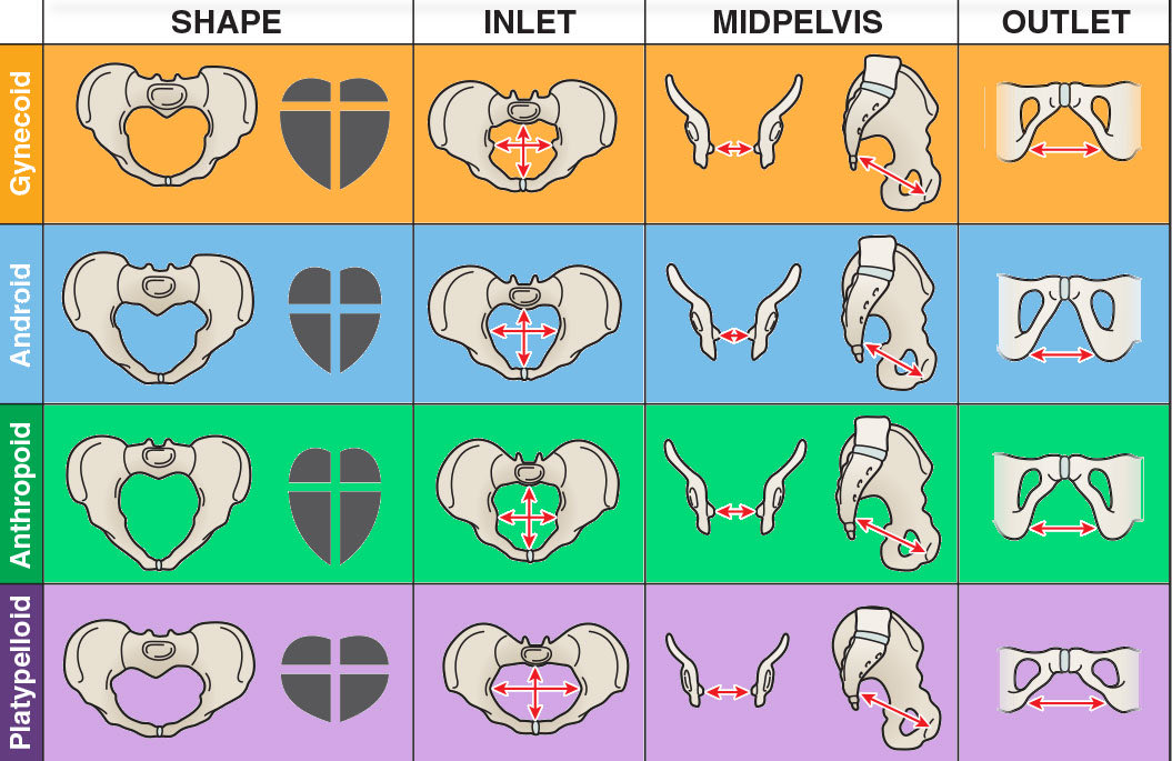 Gynaecoid is NOT the normal pelvis! Android pelvis is almost unknown in females. There’s a variety of shapes or as one study suggests a nebulous cloud. 
#Midwives &amp; #obstetricians are educated using misleading &amp; often false info about the female pelvis based on a study from 1933!