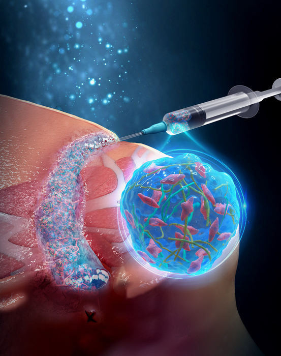 Nanofiber-hydrogel loaded with stem cells shows success treating severe complication of Crohn’s disease eurekalert.org/news-releases/… #nanotechnology #stemcells