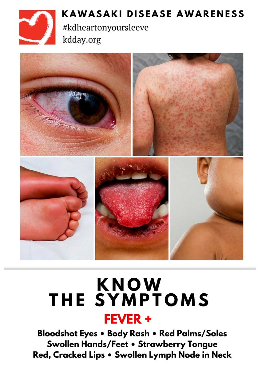 REB_JUNN's tweet photo. #KawasakiDisease #KawasakiDiseaseAwareness #KDFoundation #KDAwarenessDay #January26 #KDHeartOnYourSleeve #KdStrong #kdday2023 #kdawarenessdayAU2023 #KDday2023 #kdheartonyoursleeve #kdfoundationau #getkdonthemap #kdawarenessmonth #rarediseases #acquiredheartdisease https://t.co/h680JtnCIw