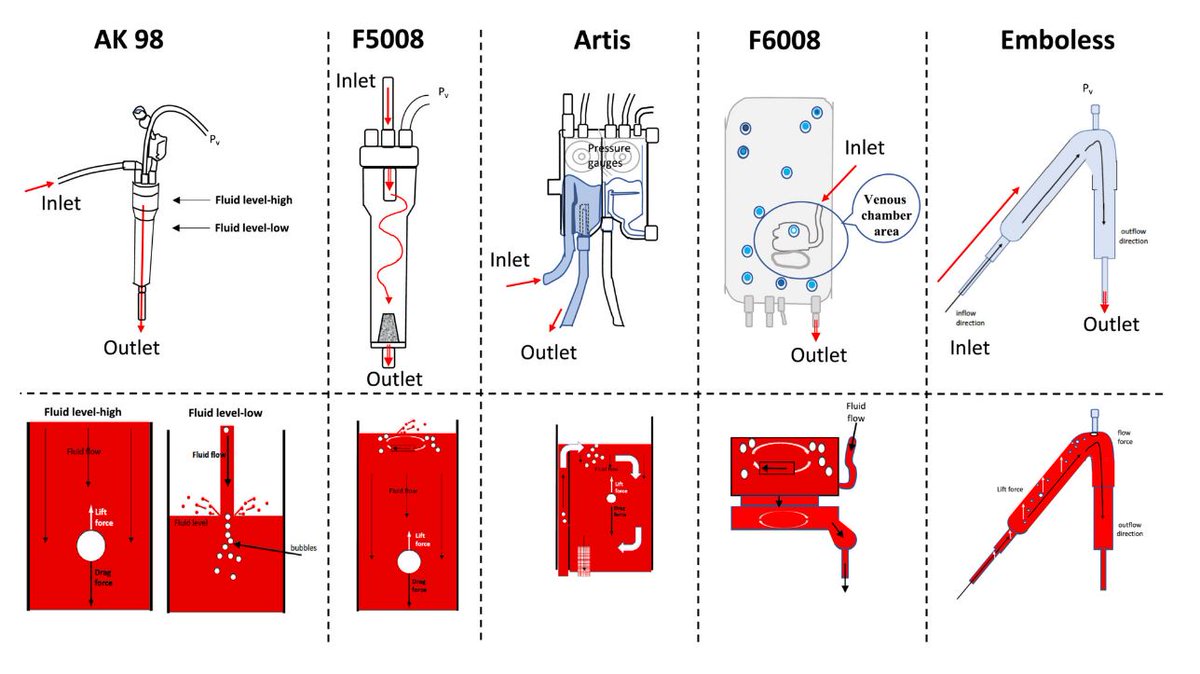 ArtifOrgans's tweet photo. #Venous chambers in clinical use for #Hemodialysis have limited capacity to eliminate #Microbubbles from entering the return #Bloodline: An #InVitro study👇
https://t.co/j9lxeqIykT
@UmeaUniversity🇸🇪| #AirBubble #Emboli #SafetyRisk https://t.co/XS8Vi3TwgA
