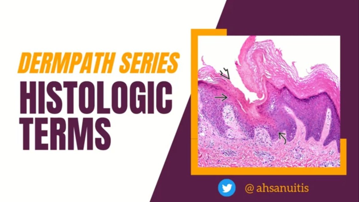 ahsanuitis's tweet photo. Are you a #pathresident or a #medstudent interested in  #dermpath? Learn about some of the histologic terms used in #dermpath.

📺 Check out my educational video, as a part of a @DCF_path: https://t.co/UKSmT4Y06t

Thanks to @JMGardnerMD for being my mentor for this! https://t.co/pFnbRne623