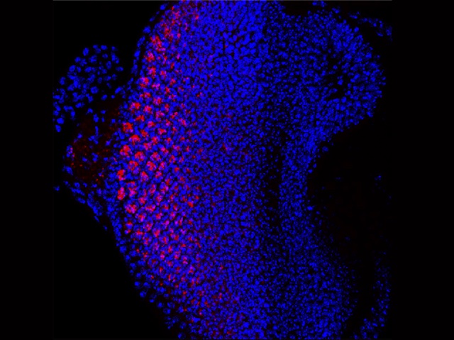Biomedical Picture of the Day BPoD (@bpod_s) on Twitter photo Raised Tom40 #mitochondria protein in #Alzheimers modelled in #drosophila links with #neurodegeneration. Image Naomi Mitchell. Research Agalya Periasamy et al <a href="/Quinn_Lab/">Prof. Leonie Quinn</a> <a href="/JCSMR/">John Curtin School of Medical Research, ANU</a> Gulbis lab <a href="/WEHI_research/">WEHI (Walter and Eliza Hall Institute)</a> in <a href="/SciReports/">Scientific Reports</a>. More bpod.mrc.ac.uk/archive/2023/1… with <a href="/MRC_LMS/">MRC Laboratory of Medical Sciences (LMS)</a> & <a href="/DrJohnAnkers/">John Ankers</a> Raised Tom40 #mitochondria protein in #Alzheimers modelled in #drosophila links with #neurodegeneration. Image Naomi Mitchell. Research Agalya Periasamy et al <a href="/Quinn_Lab/">Prof. Leonie Quinn</a> <a href="/JCSMR/">John Curtin School of Medical Research, ANU</a> Gulbis lab <a href="/WEHI_research/">WEHI (Walter and Eliza Hall Institute)</a> in <a href="/SciReports/">Scientific Reports</a>. More bpod.mrc.ac.uk/archive/2023/1… with <a href="/MRC_LMS/">MRC Laboratory of Medical Sciences (LMS)</a> & <a href="/DrJohnAnkers/">John Ankers</a>