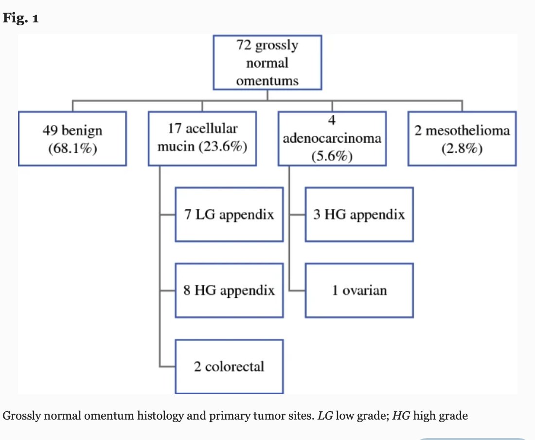 Annals of Surgical Oncology (@annsurgoncol) on Twitter photo FEBRUARY ISSUE: Is Routine #Omentectomy a Necessary Component of #CytoreductiveSurgery and #HIPEC? rdcu.be/c4a8j <a href="/McMastersKelly/">Kelly McMasters, MD, PhD</a> <a href="/SocSurgOnc/">Society of Surgical Oncology</a> FEBRUARY ISSUE: Is Routine #Omentectomy a Necessary Component of #CytoreductiveSurgery and #HIPEC? rdcu.be/c4a8j <a href="/McMastersKelly/">Kelly McMasters, MD, PhD</a> <a href="/SocSurgOnc/">Society of Surgical Oncology</a>