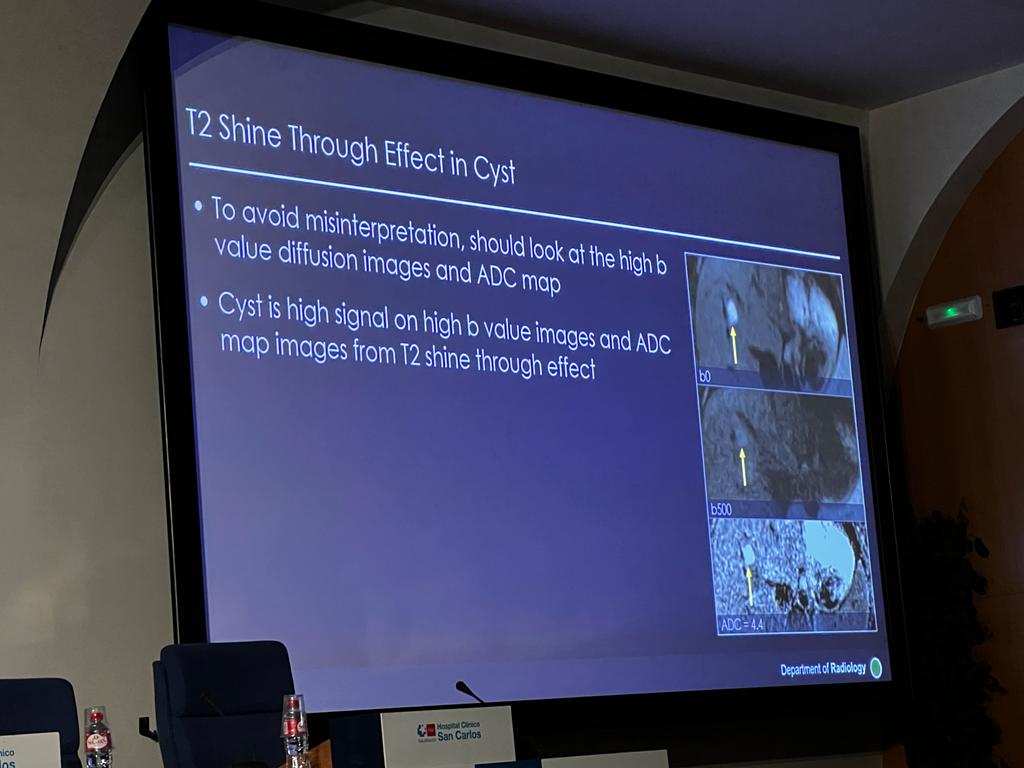 Frank Miller viene desde Chicago para contarnos su experiencia con la RM con difusión de hígado y páncreas.

#HTMédica #CursoTécnicasImagenMédicaAvanzada #Radiología