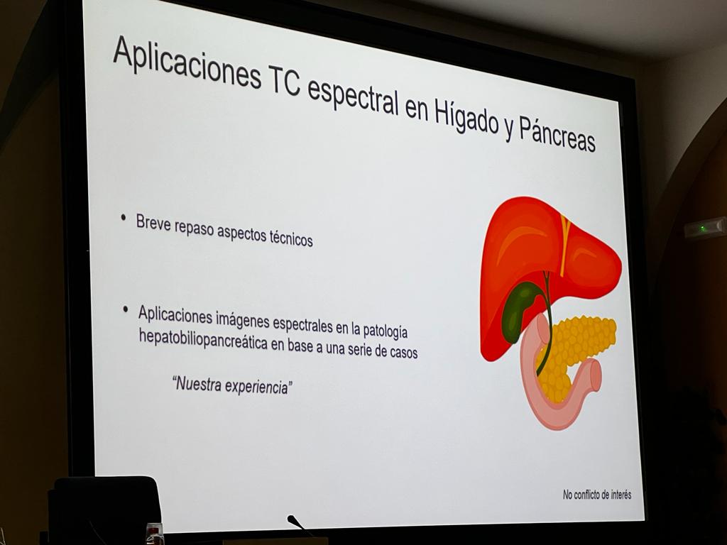 Desde la Sección de Radiología abdominal del Hospital Ramón y Cajal de Madrid llega Elena Canales para hablarnos sobre las Aplicaciones de la TC espectral en hígado y páncreas.

#HTMédica #CursoTécnicasImagenMédicaAvanzada #Radiología