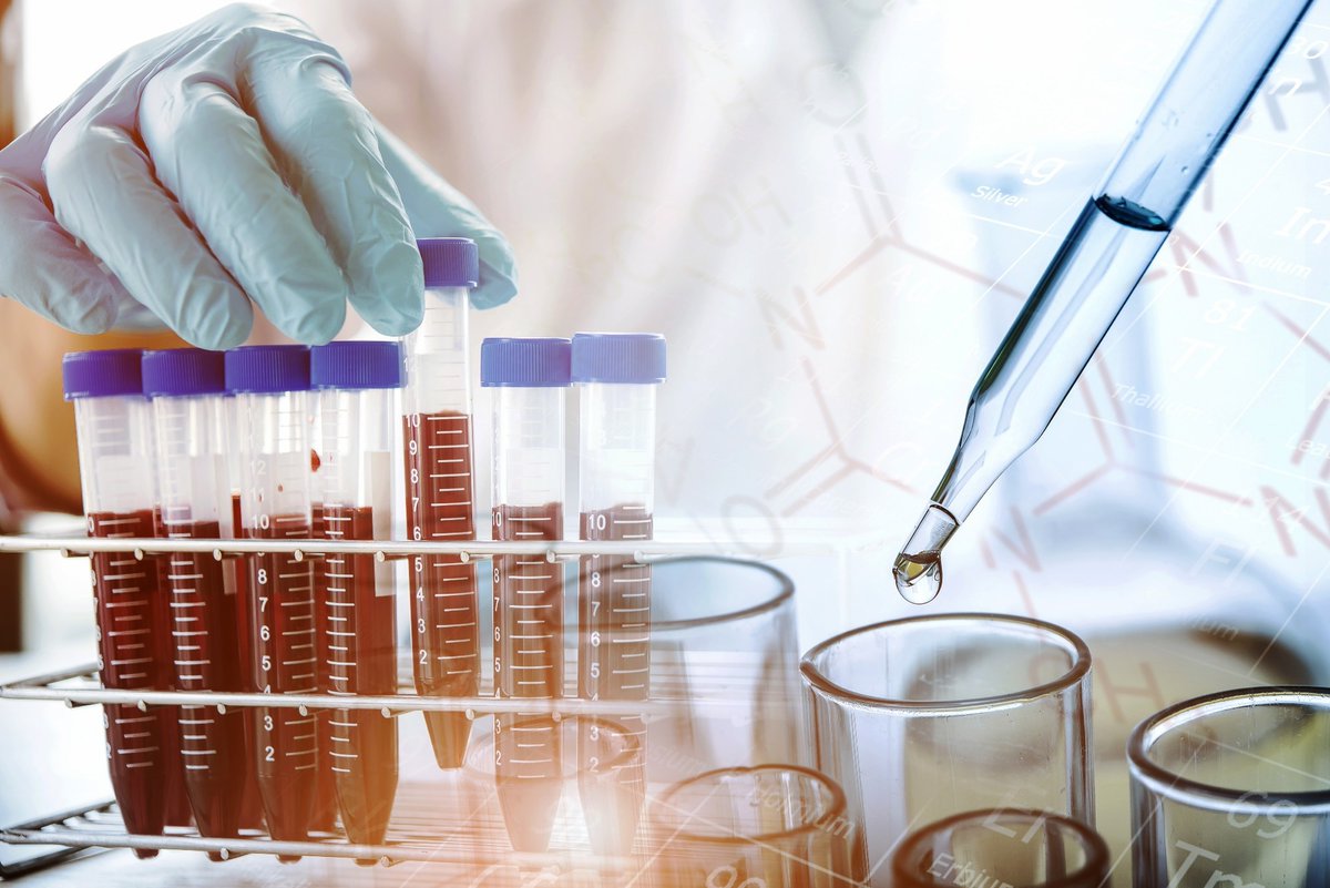NewsMedical's tweet image. Researchers develop a new multi-omics microsampling method for complete health profiling news-medical.net/news/20230126/… @NaturePortfolio @StanfordMed #Multiomics #Microsampling #HealthProfiling