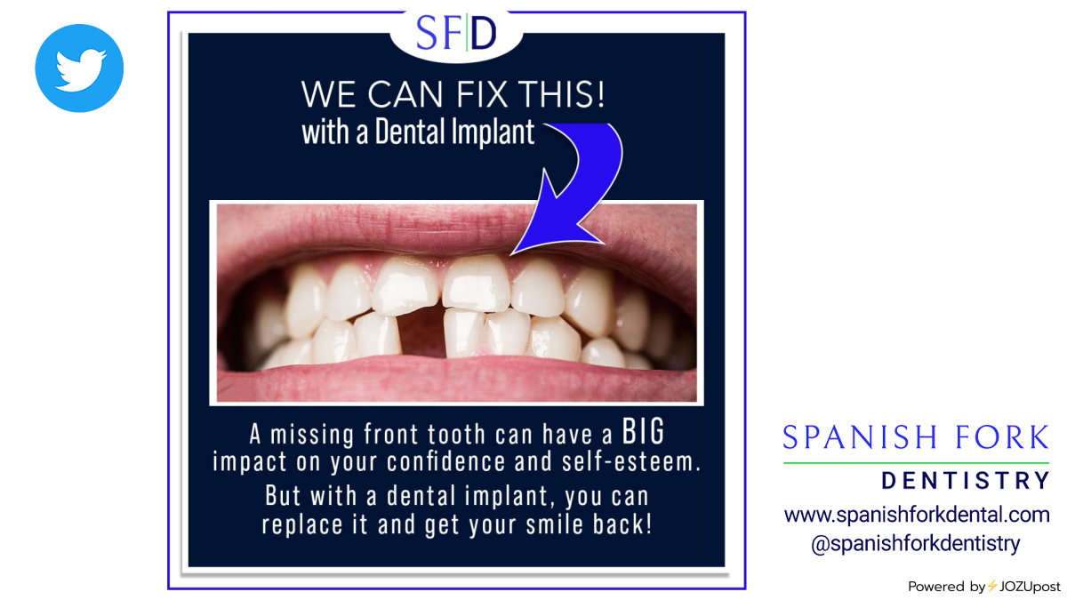 SpanishForkDent's tweet image. Missing a front tooth can be a source of embarrassment and self-consciousness. But with a dental implant, you can easily regain confidence and smile. #dentalimplants #missingteeth #fronttooth #oralhealth
jozu.me/lvd