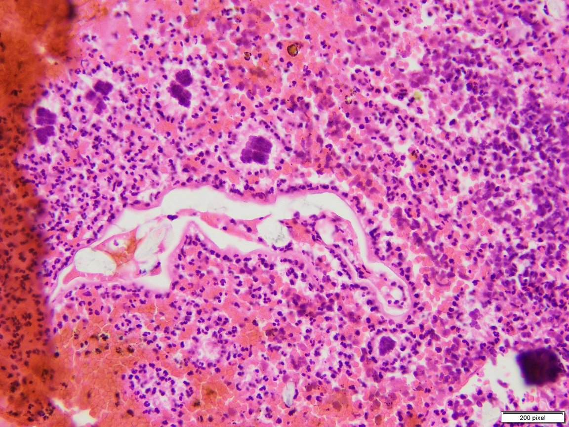ChughtaiPathRes's tweet photo. Clostridium ventriculi (formally called Sarcina) 
🍀 Classic "Tetrad" like organisms seen in this gastric biopsy 
#PathTwitter #microbiology https://t.co/zN0y6Wjf5J