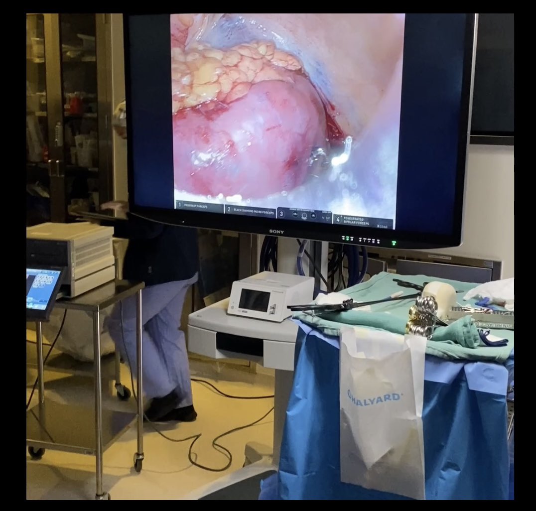 Kicking off our robotic kidney transplant program <a href="/MethodistHosp/">Houston Methodist</a> So proud of the surgical team and new surgical partners to help add to our robotic transplant numbers #kidneytransplant <a href="/aogaber/">A.Osama Gaber</a> <a href="/HMethodistMD/">Houston Methodist MD</a> #roboticsurgery