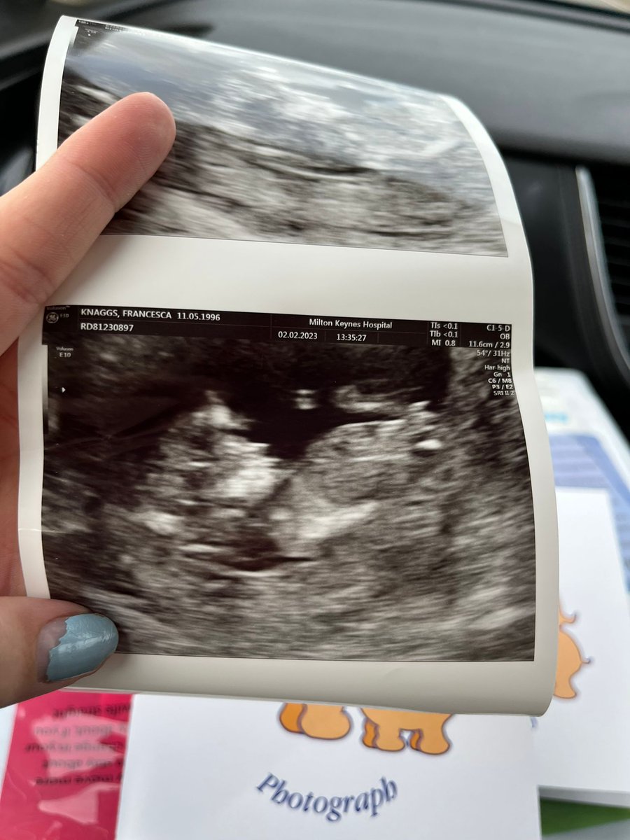 Shredder71's tweet photo. So happy, grandchild number 2 on the way. Congratulations @franniiknaggs and Raheem. https://t.co/LizR8h5RM5