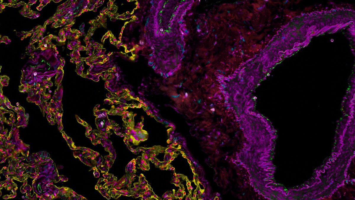 RareCyte's tweet photo. To those attending #SignaLife Spatial Resolution of Genes Expression conference @Univ_CotedAzur tomorrow, join us at Dr Coralie Gerin's @institut_curie &amp; @MickaelMeyrand’s presentations showcasing our #spatialbiology technologies!
#tissuecytometry #singlecell #multiplexmicroscopy https://t.co/pFT145D9mt